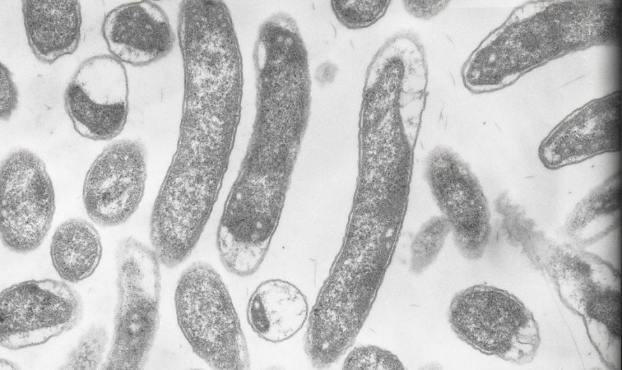 Не спасает ни один препарат. Какие бактерии устойчивы к антибиотикам?